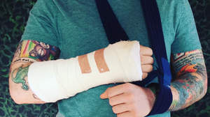 エド・シーラン、自転車の事故で腕を負傷
